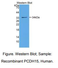 人原钙黏素15(PCDH15)多克隆抗体