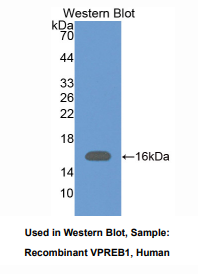 https://msimg.bioon.com/bionline/goods-no-pic.png