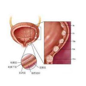 膀胱癌动物模型  泌尿系统模型