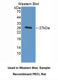 https://msimg.bioon.com/bionline/goods-no-pic.png