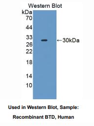 人生物素酰胺酶(BTD)多克隆抗体