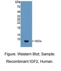 https://msimg.bioon.com/bionline/goods-no-pic.png