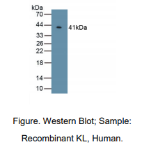 人可罗索(KL)多克隆抗体
