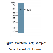 https://msimg.bioon.com/bionline/goods-no-pic.png