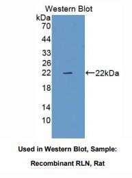 https://msimg.bioon.com/bionline/goods-no-pic.png