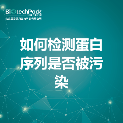 https://msimg.bioon.com/bionline/goods-no-pic.png