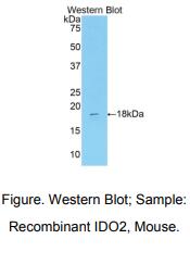 https://msimg.bioon.com/bionline/goods-no-pic.png