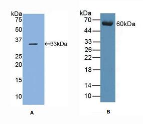 人抑制蛋白β1(ARRb1)多克隆抗体