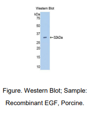 https://msimg.bioon.com/bionline/goods-no-pic.png