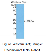 https://msimg.bioon.com/bionline/goods-no-pic.png