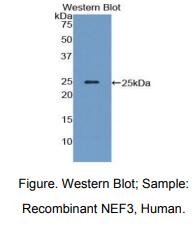 人神经丝蛋白3(NEF3)多克隆抗体