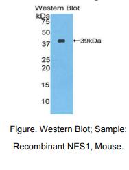 https://msimg.bioon.com/bionline/goods-no-pic.png