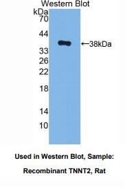 大鼠心肌肌钙蛋白T(TNNT2)多克隆抗体