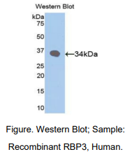 人视黄醇结合蛋白3(RBP3)多克隆抗体