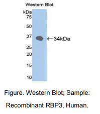 https://msimg.bioon.com/bionline/goods-no-pic.png