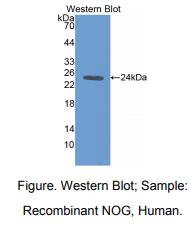 https://msimg.bioon.com/bionline/goods-no-pic.png