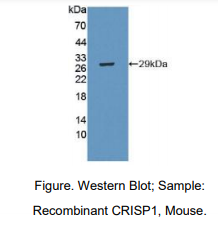 小鼠半胱氨酸丰富分泌蛋白1(CRISP1)多克隆抗体