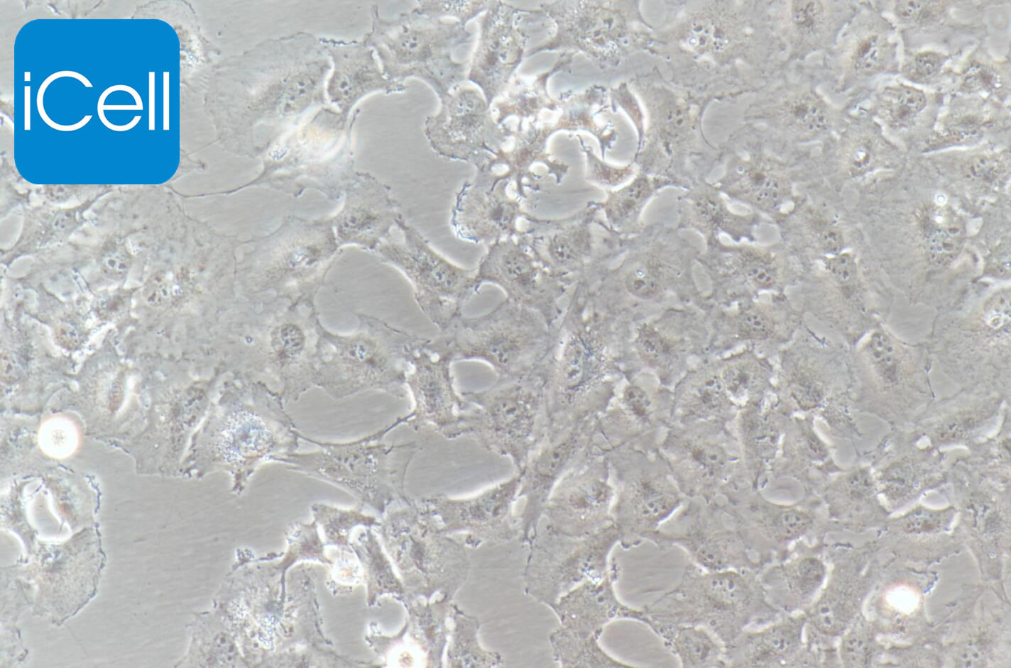 HS578T细胞/HS-578T细胞/HS578T/HS-578T/人乳腺癌细胞