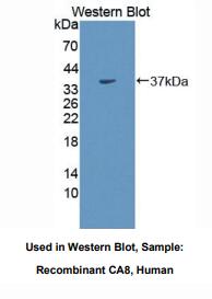 https://msimg.bioon.com/bionline/goods-no-pic.png