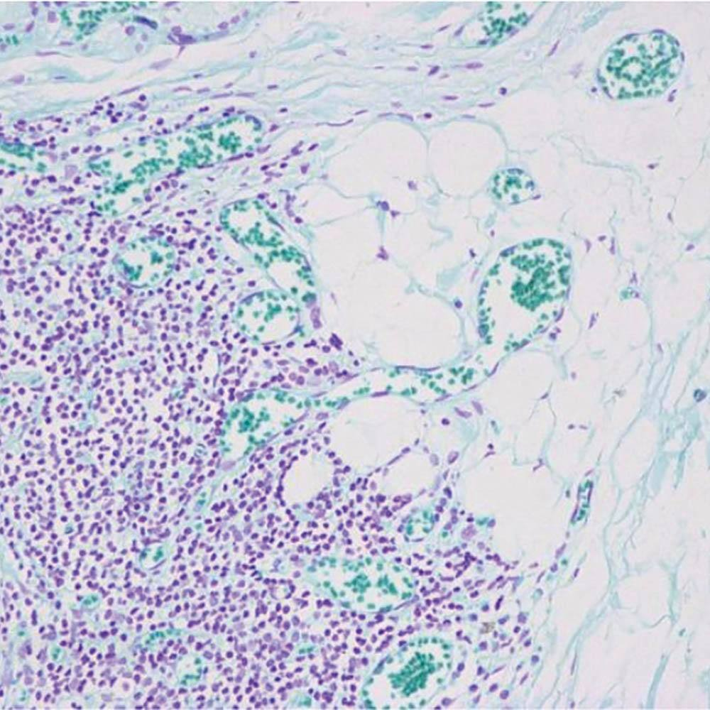 https://msimg.bioon.com/bionline/goods-no-pic.png