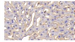 兔细胞间粘附分子1(ICAM1)多克隆抗体