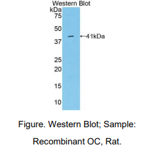 https://msimg.bioon.com/bionline/goods-no-pic.png