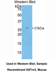 小鼠谷胱甘肽S转移酶μ2(GSTM2)多克隆抗体