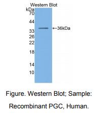 https://msimg.bioon.com/bionline/goods-no-pic.png