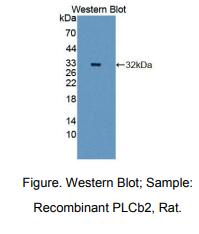 大鼠磷酯酶Cβ2(PLCb2)多克隆抗体