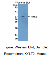 小鼠木糖基转移酶Ⅱ(XYLT2)多克隆抗体