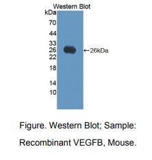 小鼠血管内皮生长因子B(VEGFB)多克隆抗体