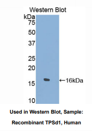 https://msimg.bioon.com/bionline/goods-no-pic.png