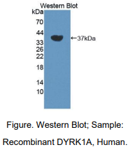 人双特异性酪氨酸磷酸化调节激酶1A(DYRK1A)多克隆抗体