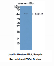 https://msimg.bioon.com/bionline/goods-no-pic.png