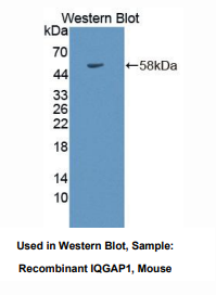 https://msimg.bioon.com/bionline/goods-no-pic.png