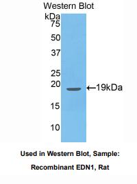 https://msimg.bioon.com/bionline/goods-no-pic.png