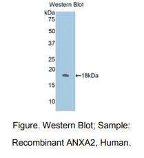 人膜联蛋白A2(ANXA2)多克隆抗体
