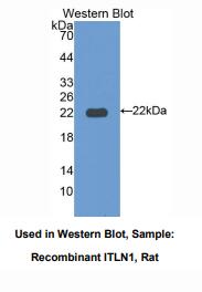 https://msimg.bioon.com/bionline/goods-no-pic.png