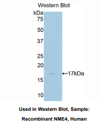 人非转移细胞4表达NM23A蛋白(NME4)多克隆抗体