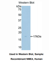 https://msimg.bioon.com/bionline/goods-no-pic.png