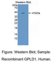 人糖基化磷脂酰肌醇特异性磷脂酶D1(GPLD1)多克隆抗体