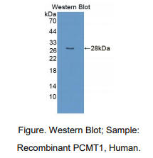 人蛋白L-异天冬氨酸-O-甲基转移酶(PCMT1)多克隆抗体
