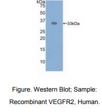 https://msimg.bioon.com/bionline/goods-no-pic.png