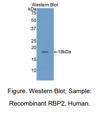 人视黄醇结合蛋白2(RBP2)多克隆抗体