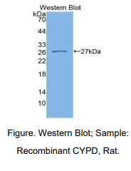 https://msimg.bioon.com/bionline/goods-no-pic.png