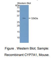 https://msimg.bioon.com/bionline/goods-no-pic.png