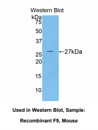 https://msimg.bioon.com/bionline/goods-no-pic.png