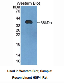 大鼠热休克转录因子4(HSF4)多克隆抗体