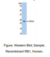 人视网膜母细胞瘤蛋白1(RB1)多克隆抗体