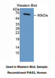 人激活STAT蛋白抑制因子3(PIAS3)多克隆抗体